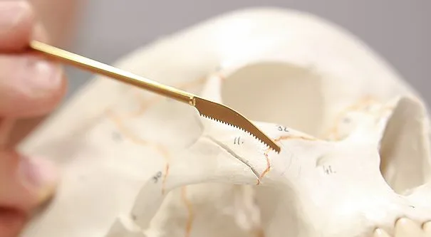 J-SAW on a skull model